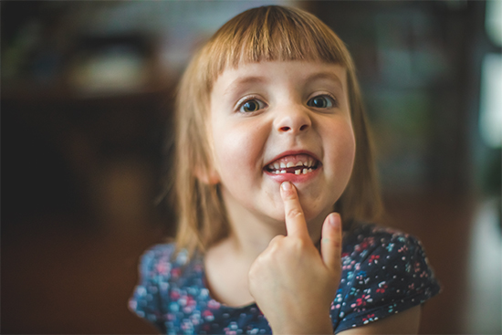 child smiling with missing tooth